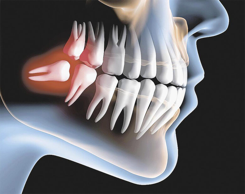 Cirurgia oral