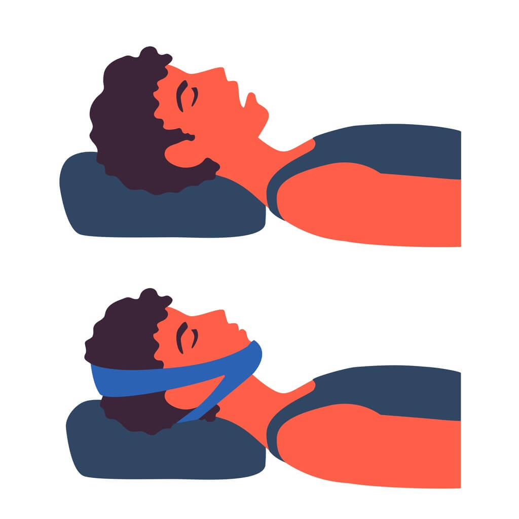 Um homem dormindo sem e com a faixa do maxilar. Um curativo de alça de queixo. Anti-ronco, ajuda à apneia. Uma pessoa de boca aberta e fechada. Tratamento anti-ronco, solução.